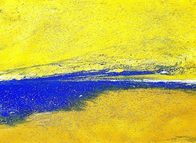 후후, Yellow 31